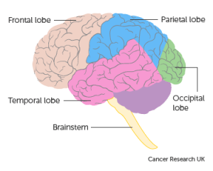 bagian bagian gejala kanker otak